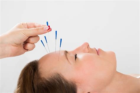 Tracing The Origins Of Acupuncture A Practice In Traditional Chinese
