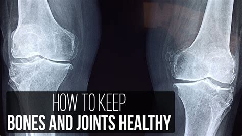 Your Bones Are Getting Weaker How To Keep Them Healthy Health