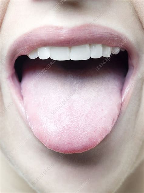 Womans Tongue Stock Image F0039346 Science Photo