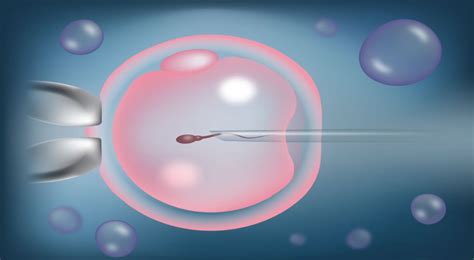 Micro Manipulation Icsi Intracytoplasmic Sperm Injection