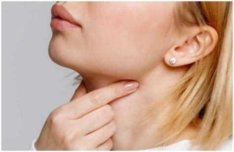 Gonorrhea Symptoms Sore Throat Riskgulu