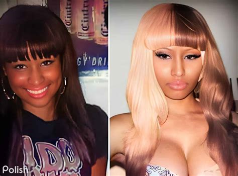 Nicki Minaj Before And After Skin Bleaching Nickis Transformation