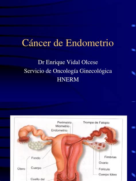 Cancer De Endometrioppt Cáncer Rtt