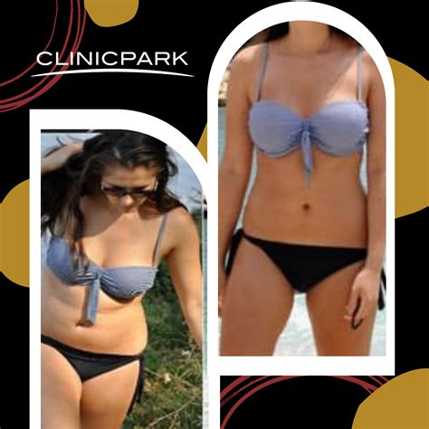 Tummy Tuck Turkey - Clinicpark