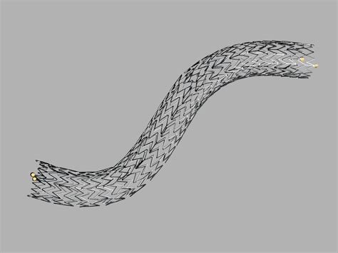 Zilver Biliary Self Expanding Stent