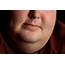 FDA Approves Drug To Combat Fat Underneath The Chin  Clevelandcom