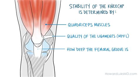 The Dislocated Patella Or Kneecap It Is More Common Than You Think