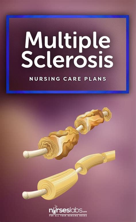 9 Multiple Sclerosis Nursing Care Plans Nursing Care Plan Nursing