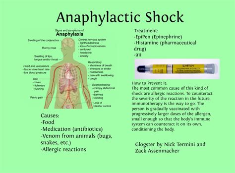 Pathophysiology Of Anaphylactic Shock