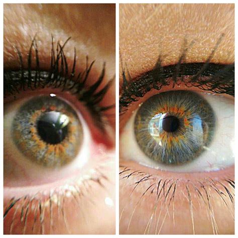 Best Central Heterochromia Images On Pholder Eyes Heterochromia