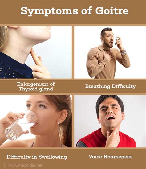 Goitre Thyroid Swelling Symptoms And Treatment Patient