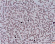 Sep 01, 2019 · negative feedback is demonstrated in the regulation of red blood cell production or erythropoiesis. Nucleated red blood cell - Wikipedia