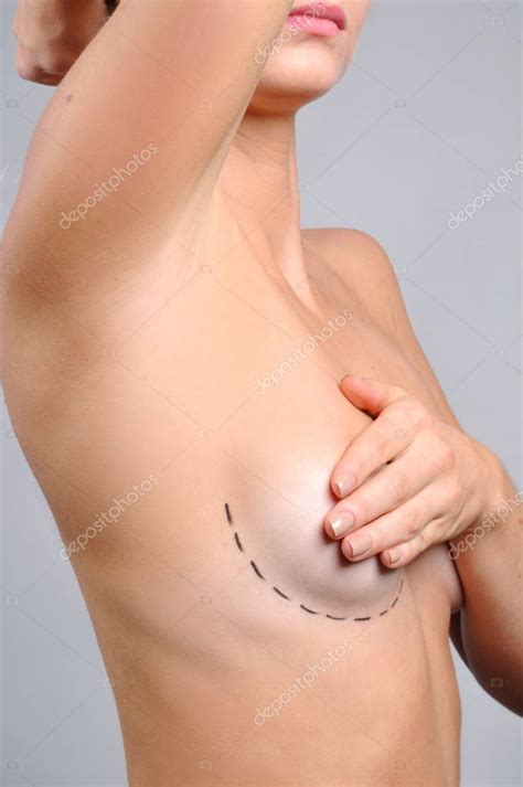 Plastic Surgery Naked Body Woman Breast With Dotted Lines Before