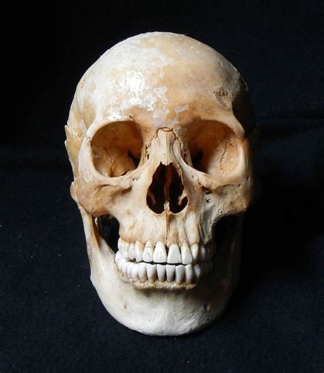 Jun 02, 2021 · we sampled all the major organelles of the human cell and used innovative analysis to create the highest resolution map to date, with high accuracy in predicting novel localizations for many. Authentic Genuine Real Human Skull - Uncut Articulated for ...