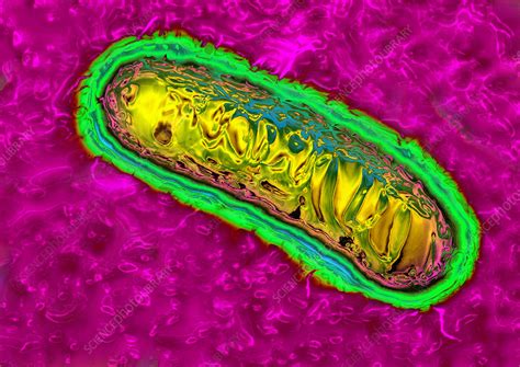 Pseudomonas aeruginosa in healthcare settings. Pseudomonas bacterium, TEM - Stock Image - C012/9950 ...