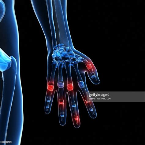 Human Finger Joints Artwork High Res Vector Graphic Getty Images