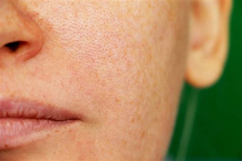Cómo cerrar los poros abiertos de la cara en tan sólo 2 minutos | Salud180