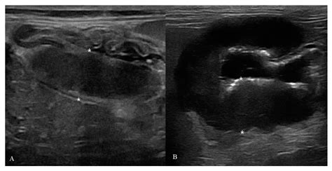 Animals Free Full Text B Mode And Contrast Enhanced Ultrasonography