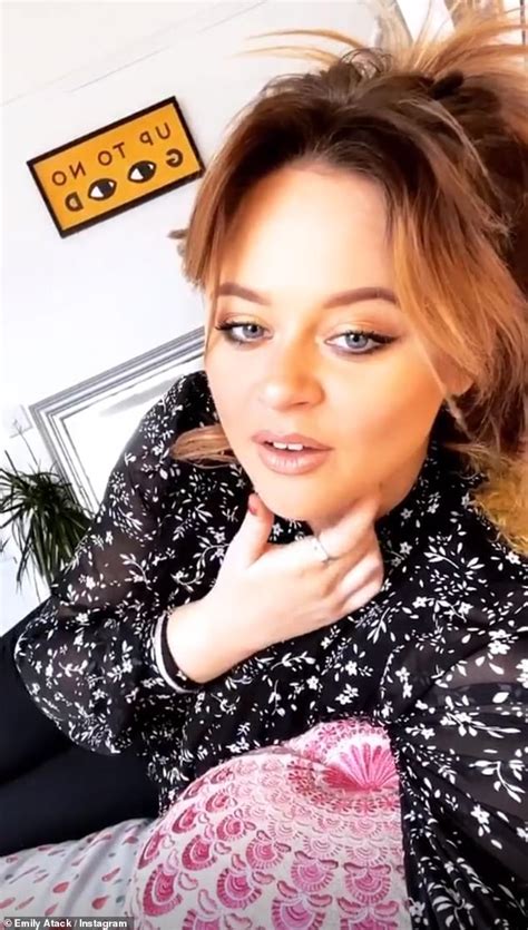 Emily Atack Shows Off Her Freckles After Sunbathing As She Makes The