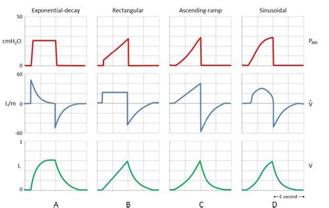 In some cases, you likewise do not discover the pronouncement rapid interpretation of ventilator waveforms that you are looking for. Click to view full image | Respiratory care, Respiratory ...