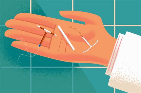 Iuds And Hormonal Implants Remain Underused Contraceptives The New