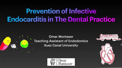 Prevention Of Infective Endocarditis In The Dental Practice Youtube