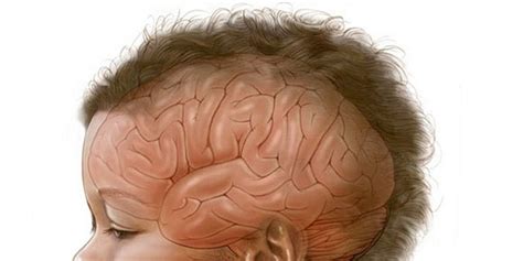 Inilah Cara Menghilangkan Kutu Rambut Secara Cepat - BERANEKA INFORMASI