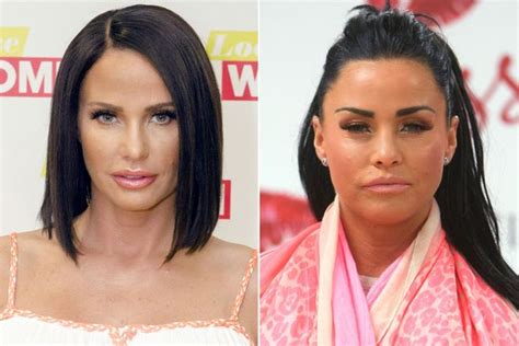 After so much botox since the age of 20 my eyebrows were uneven and now he was able to fix that. Are Celebrities Saying No To Botox And Yes To A More ...