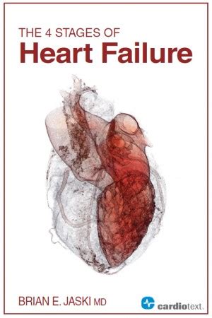 The 4 Stages Of Heart Failure Heart Failure Online