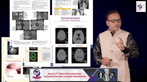 Conceptual Review Of Radiology Game Changer Book For Pgmee Youtube