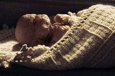 • real life benjamin button baby please like comment and suscribe. Real-life Benjamin Buttons: these babies were born looking ...
