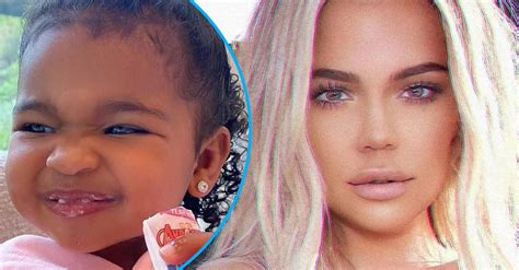 Khloe Kardashian Shares Adorable Buck Teeth Pic On Daughter True: 'My Baby Bunny'