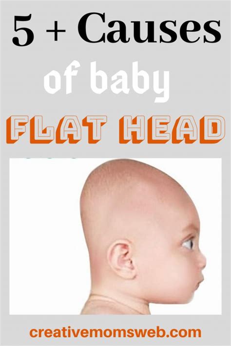 Causes Of A Flat Head Syndrome Flat Head Syndrome Flat Head Baby