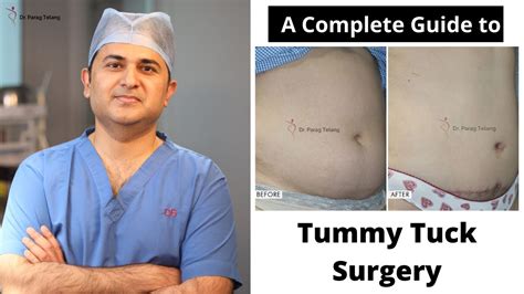 Tummy Tuck Surgery Complete Guide Types Of Tummy Tuck Surgery Tummy