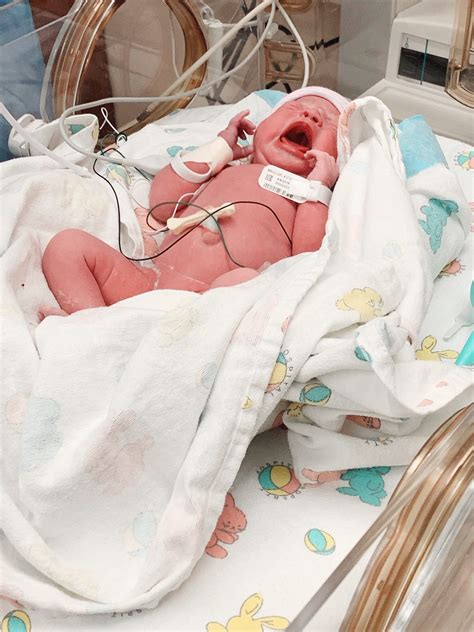Baby Born At 33 Weeks 1 Day May 2019 Babies Forums What To Expect
