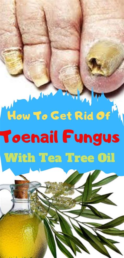 Tea tree oil not only removes facial hair, but also rejuvenates the skin and helps to clear bacteria / germs. Does Tea Tree Oil Work for Nail Fungus? Click Here to ...