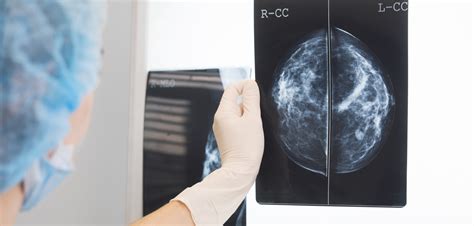 3 D Mammography Could Reduce The Need For Breast Biopsies Cancer Health