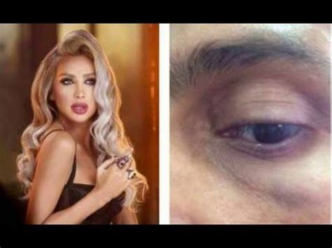 تقديم الخبر على المبتدأ جوازا. صور صادمة للإصابات واللكمات التي تعرض لها رامز جلال فى ...