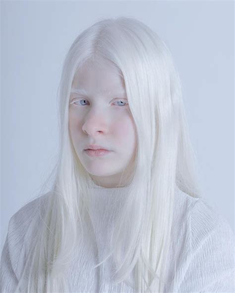 Pin By Gothic Albino On E D I T O R I A L Albino Girl Albinism