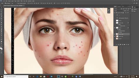 How To Remove Pimple In 1 Minute In Photoshop Tutorial Youtube