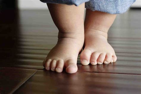 Childrens Foot Problems Perform Podiatry