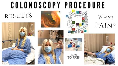 Colonoscopy What You Need To Know About A Colonoscopy Prep The Most Important And Worst Part