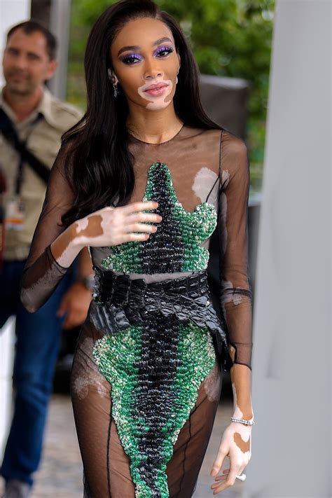 Winnie Harlow Sexy 39 Photos Thefappening