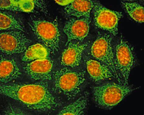 Elodea is green and goes through photosynethis, pepper does not and is red. Double duty - green quantum dots cling to mitochondria in ...