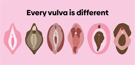 Different Vulvas