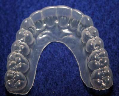 When cleaning a retainer, that material can warp if you use harsh chemicals such as pepsi cola and other soda beverages. Barnett Orthodontics Blog - Invisalign, Braces & More in ...