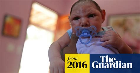 Research Claims Proof Of Link Between Zika Virus And Microcephaly In