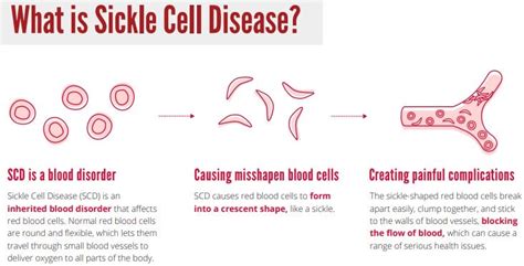 World Sickle Cell Day 2020