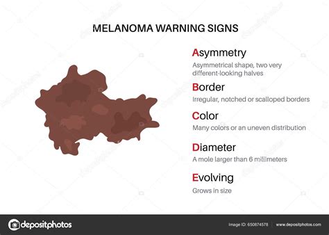 Melanoma Warning Signs Abcde Rule Skin Cancer Asymmetrical Shape
