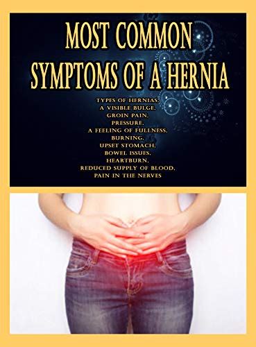 Amazon Com Most Common Symptoms Of A Hernia Types Of Hernias A My Xxx
